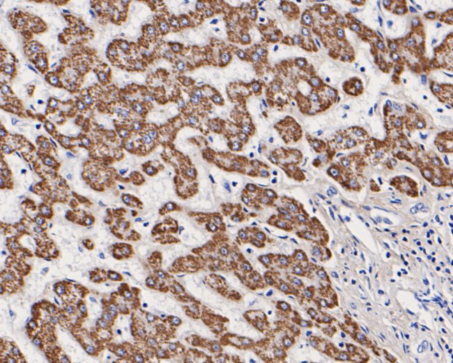 OTC Antibody in Immunohistochemistry (Paraffin) (IHC (P))