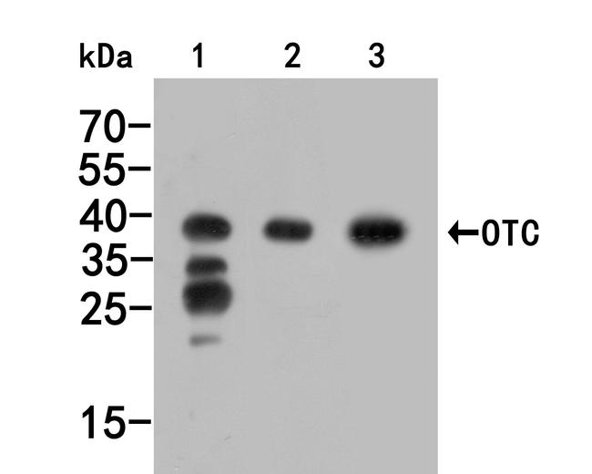 OTC Antibody in Western Blot (WB)