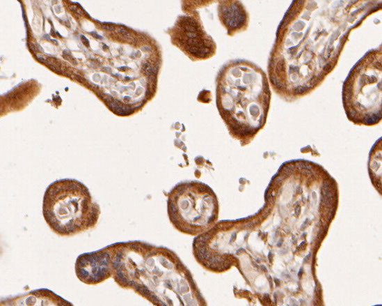 ADK Antibody in Immunohistochemistry (Paraffin) (IHC (P))