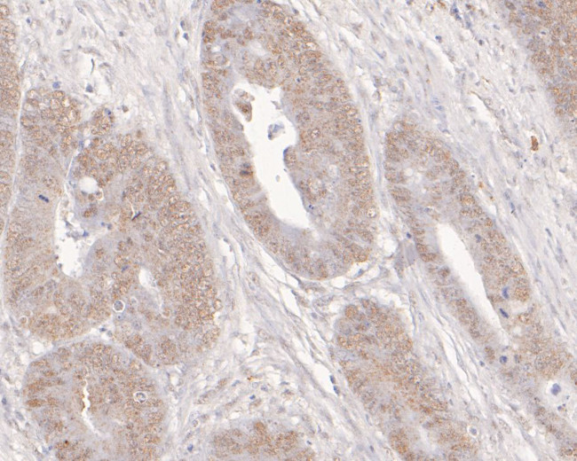 ADK Antibody in Immunohistochemistry (Paraffin) (IHC (P))