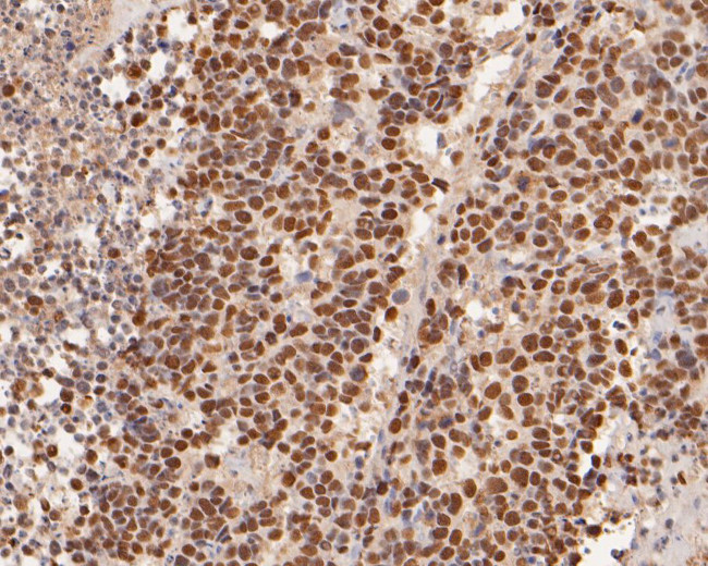 ADK Antibody in Immunohistochemistry (Paraffin) (IHC (P))