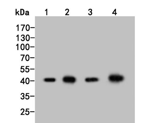 ADK Antibody in Western Blot (WB)