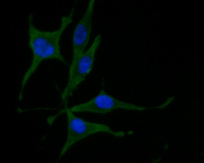 Munc13-4 Antibody in Immunocytochemistry (ICC/IF)