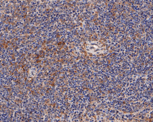 Munc13-4 Antibody in Immunohistochemistry (Paraffin) (IHC (P))