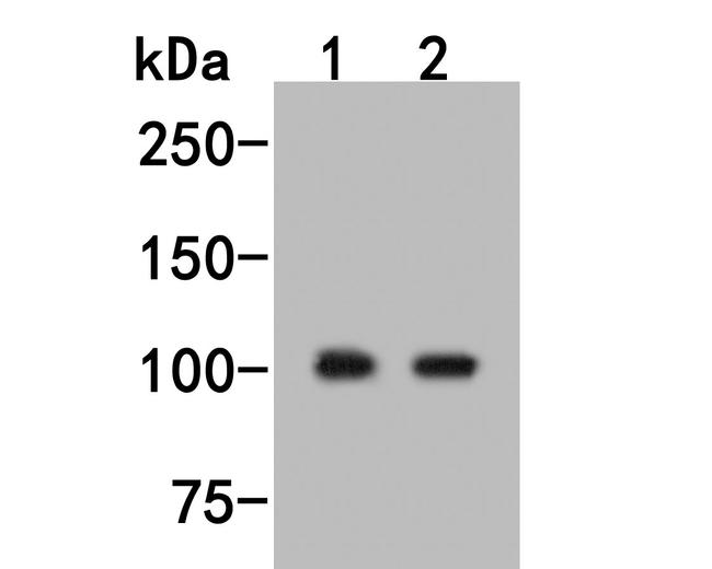 PDE2A Antibody in Western Blot (WB)