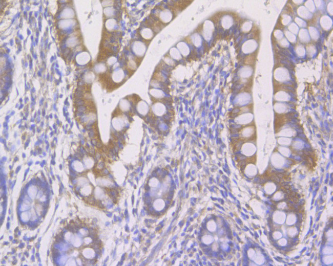 SULT1E1 Antibody in Immunohistochemistry (Paraffin) (IHC (P))