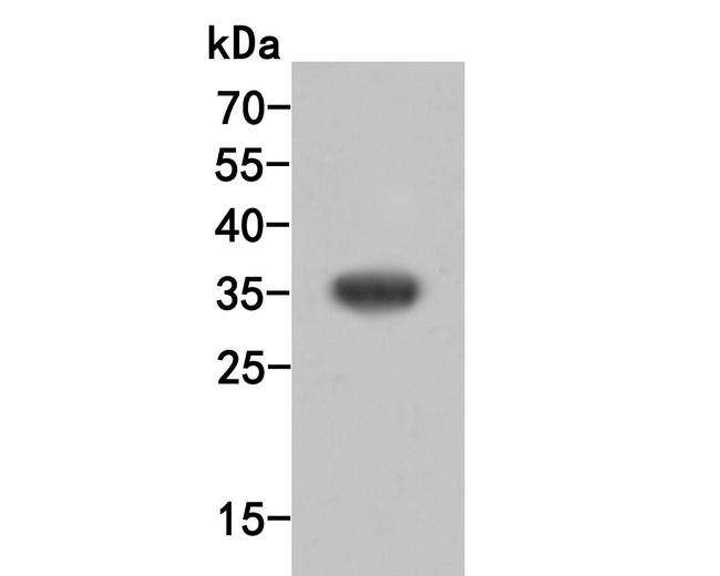 SULT1E1 Antibody in Western Blot (WB)