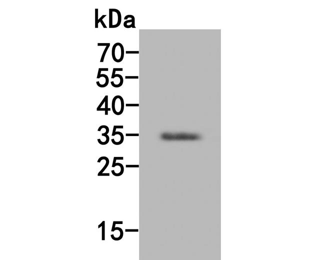 SULT1E1 Antibody in Western Blot (WB)