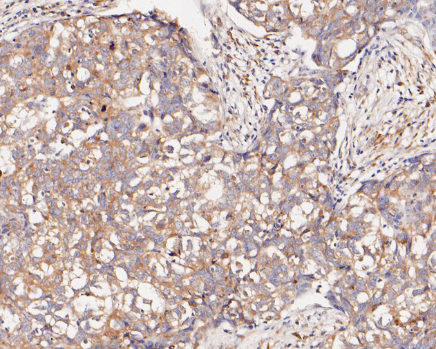 ARF4 Antibody in Immunohistochemistry (Paraffin) (IHC (P))