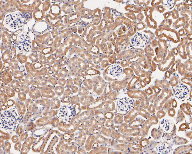 ARF4 Antibody in Immunohistochemistry (Paraffin) (IHC (P))