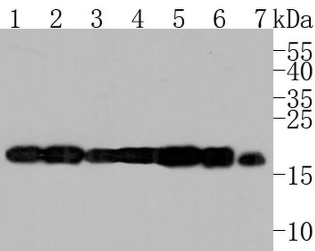 ARF4 Antibody in Western Blot (WB)