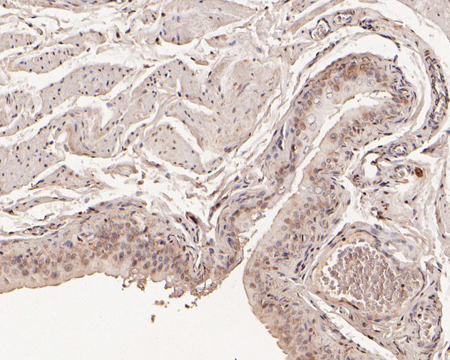 CHMP2A Antibody in Immunohistochemistry (Paraffin) (IHC (P))