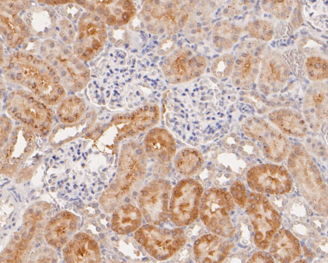 GAMT Antibody in Immunohistochemistry (Paraffin) (IHC (P))