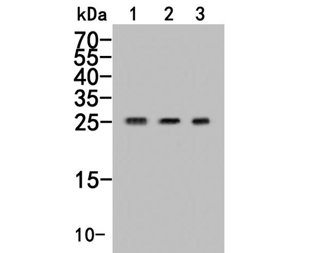 GAMT Antibody in Western Blot (WB)