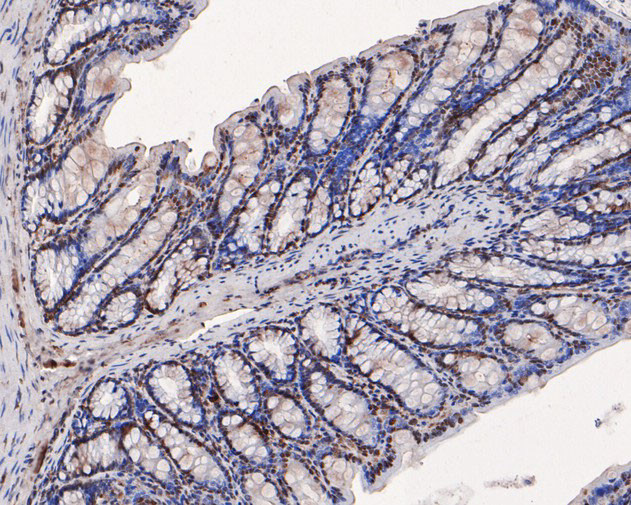 PP1 alpha Antibody in Immunohistochemistry (Paraffin) (IHC (P))