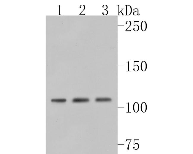 NMDAR3B Antibody in Western Blot (WB)