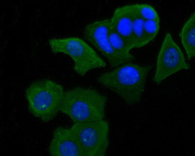 Syk Antibody in Immunocytochemistry (ICC/IF)