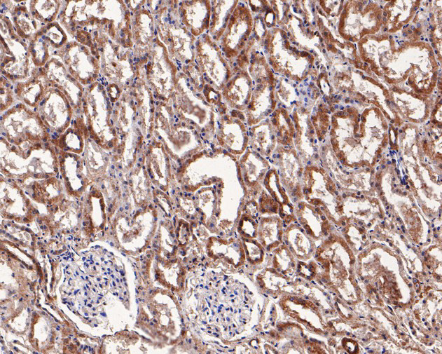 Syk Antibody in Immunohistochemistry (Paraffin) (IHC (P))