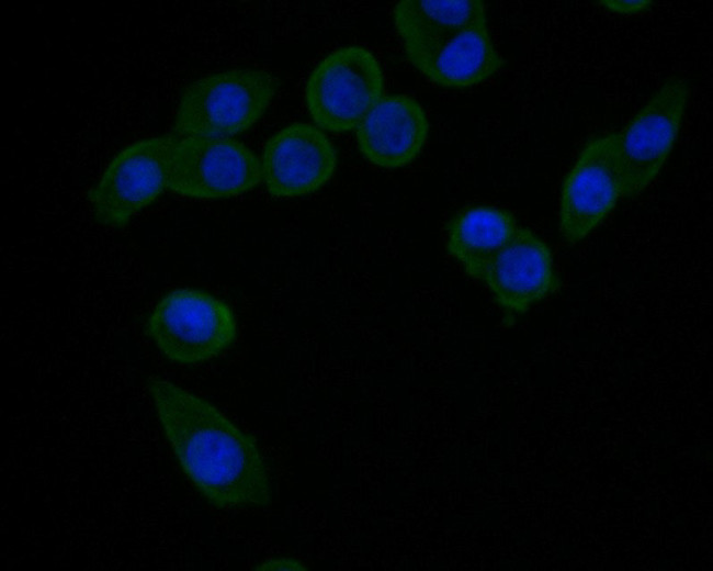 HSD3B1 Antibody in Immunocytochemistry (ICC/IF)