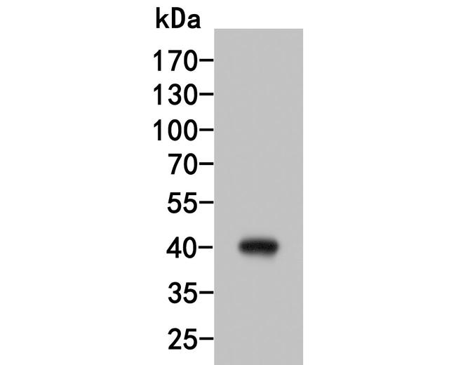 HSD3B1 Antibody in Western Blot (WB)