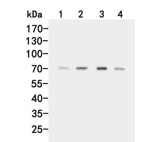 ACVR2A Antibody in Western Blot (WB)