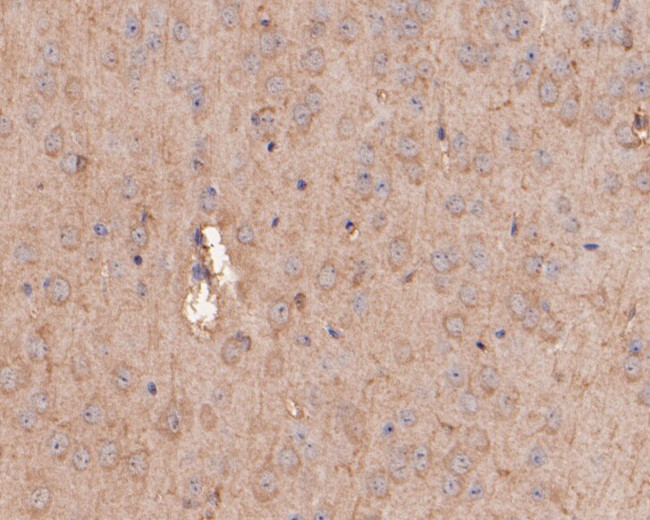 GABRG1 Antibody in Immunohistochemistry (Paraffin) (IHC (P))