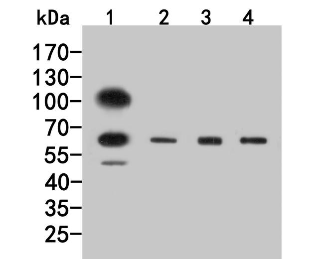 GABRG1 Antibody in Western Blot (WB)