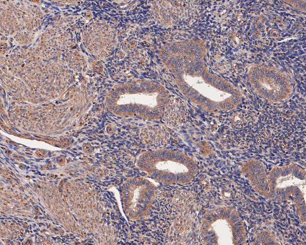 INHBB Antibody in Immunohistochemistry (Paraffin) (IHC (P))