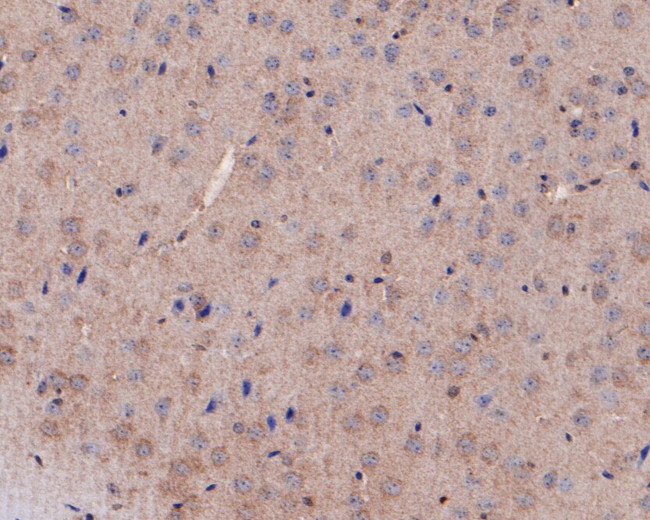 INHBB Antibody in Immunohistochemistry (Paraffin) (IHC (P))