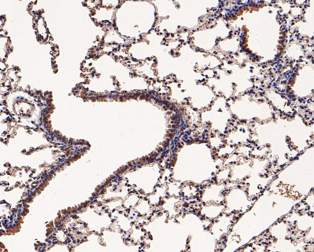 Ly-6C Antibody in Immunohistochemistry (Paraffin) (IHC (P))