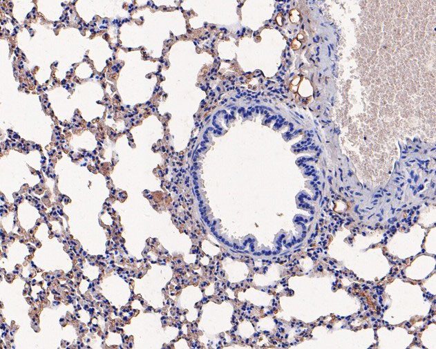 Ly-6C Antibody in Immunohistochemistry (Paraffin) (IHC (P))