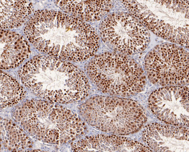 p70 S6 Kinase beta Antibody in Immunohistochemistry (Paraffin) (IHC (P))