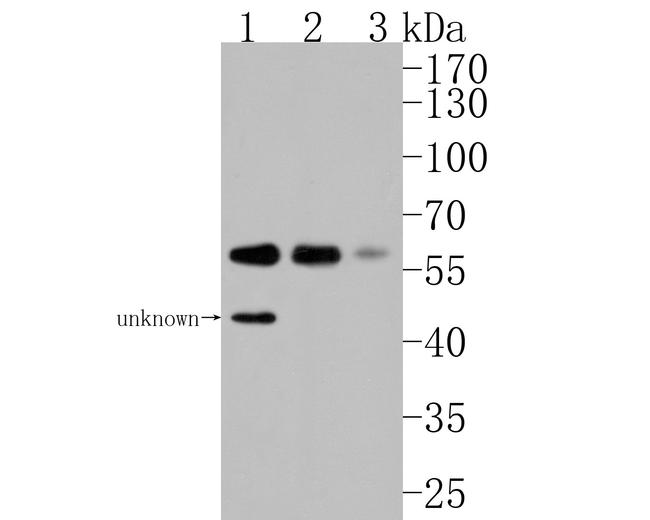 p70 S6 Kinase beta Antibody in Western Blot (WB)