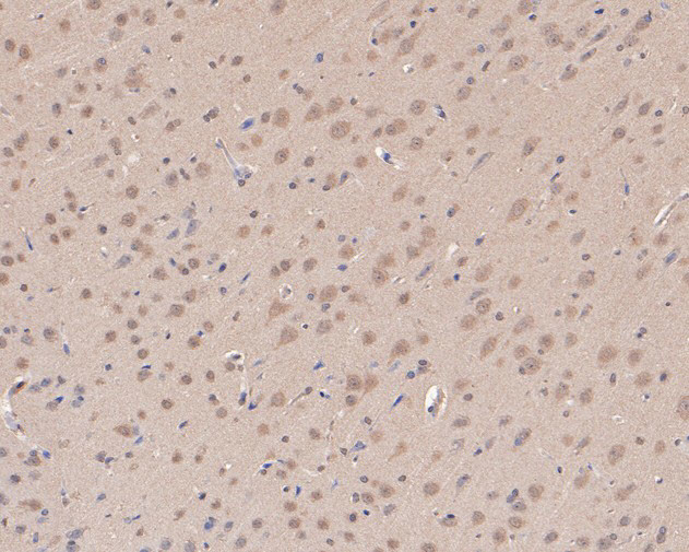 ATG14 Antibody in Immunohistochemistry (Paraffin) (IHC (P))