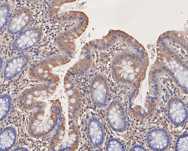 ATG14 Antibody in Immunohistochemistry (Paraffin) (IHC (P))