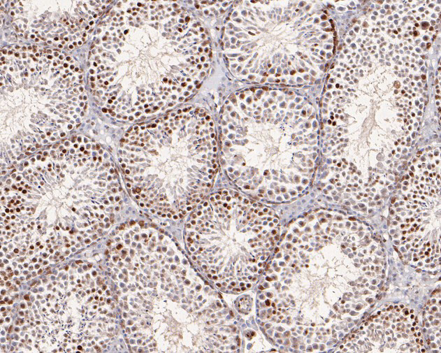 ATG14 Antibody in Immunohistochemistry (Paraffin) (IHC (P))