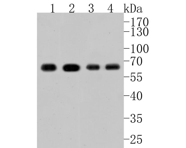 ATG14 Antibody in Western Blot (WB)