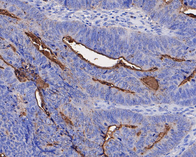 CEACAM8 Antibody in Immunohistochemistry (Paraffin) (IHC (P))