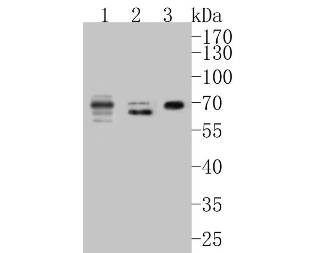 CEACAM8 Antibody in Western Blot (WB)