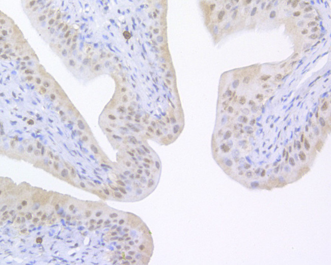 UAP56 Antibody in Immunohistochemistry (Paraffin) (IHC (P))