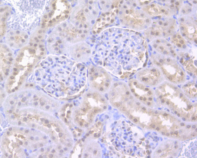 UAP56 Antibody in Immunohistochemistry (Paraffin) (IHC (P))