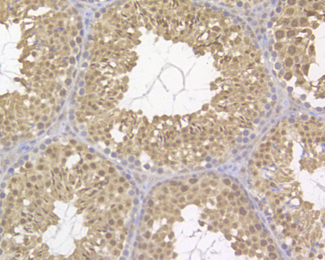 UAP56 Antibody in Immunohistochemistry (Paraffin) (IHC (P))