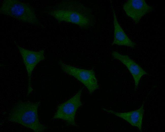 Phospholamban Antibody in Immunocytochemistry (ICC/IF)