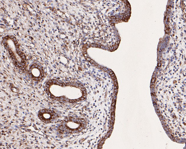 SNX9 Antibody in Immunohistochemistry (Paraffin) (IHC (P))