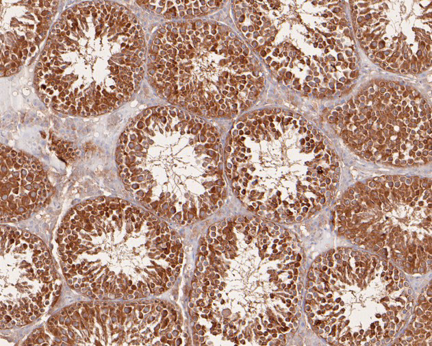 SNX9 Antibody in Immunohistochemistry (Paraffin) (IHC (P))