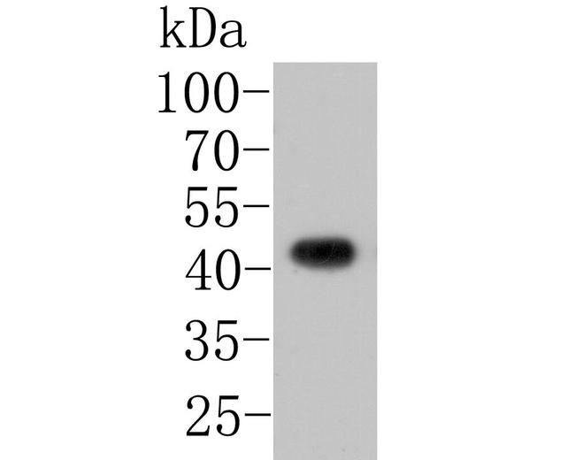 JNK2 Antibody in Western Blot (WB)