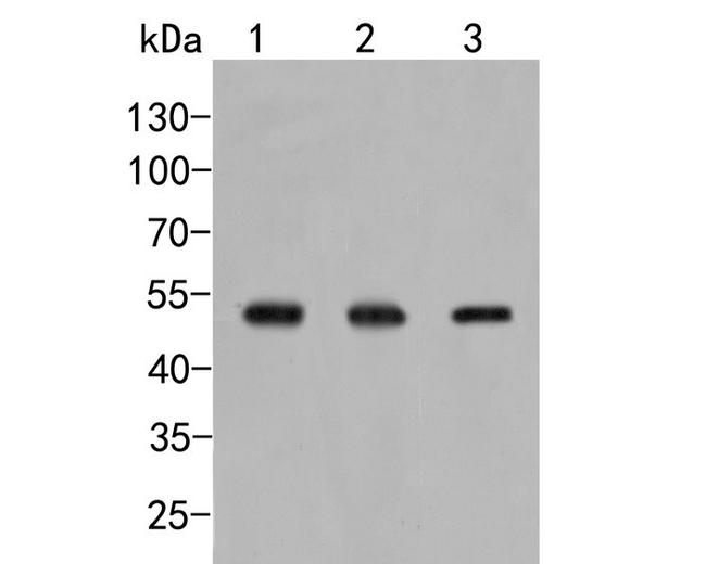 GXYLT1 Antibody in Western Blot (WB)