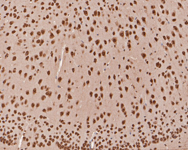 TCF21 Antibody in Immunohistochemistry (Paraffin) (IHC (P))