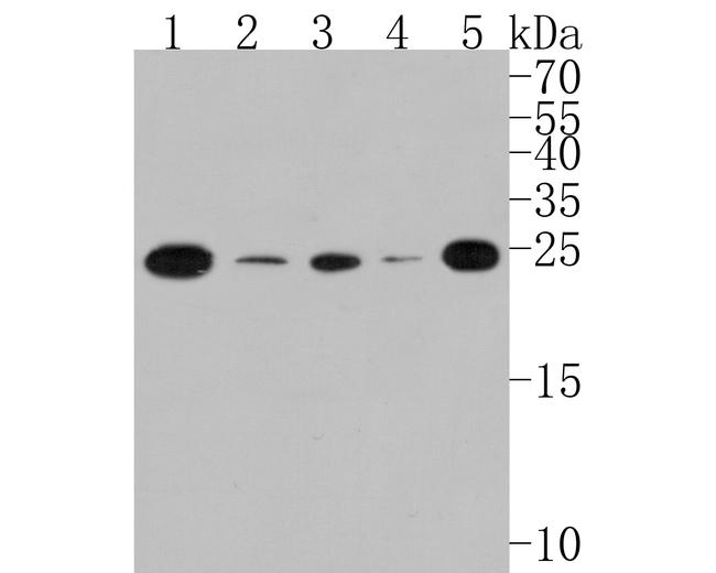 TCF21 Antibody in Western Blot (WB)