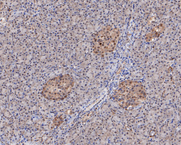 MCRS1 Antibody in Immunohistochemistry (Paraffin) (IHC (P))